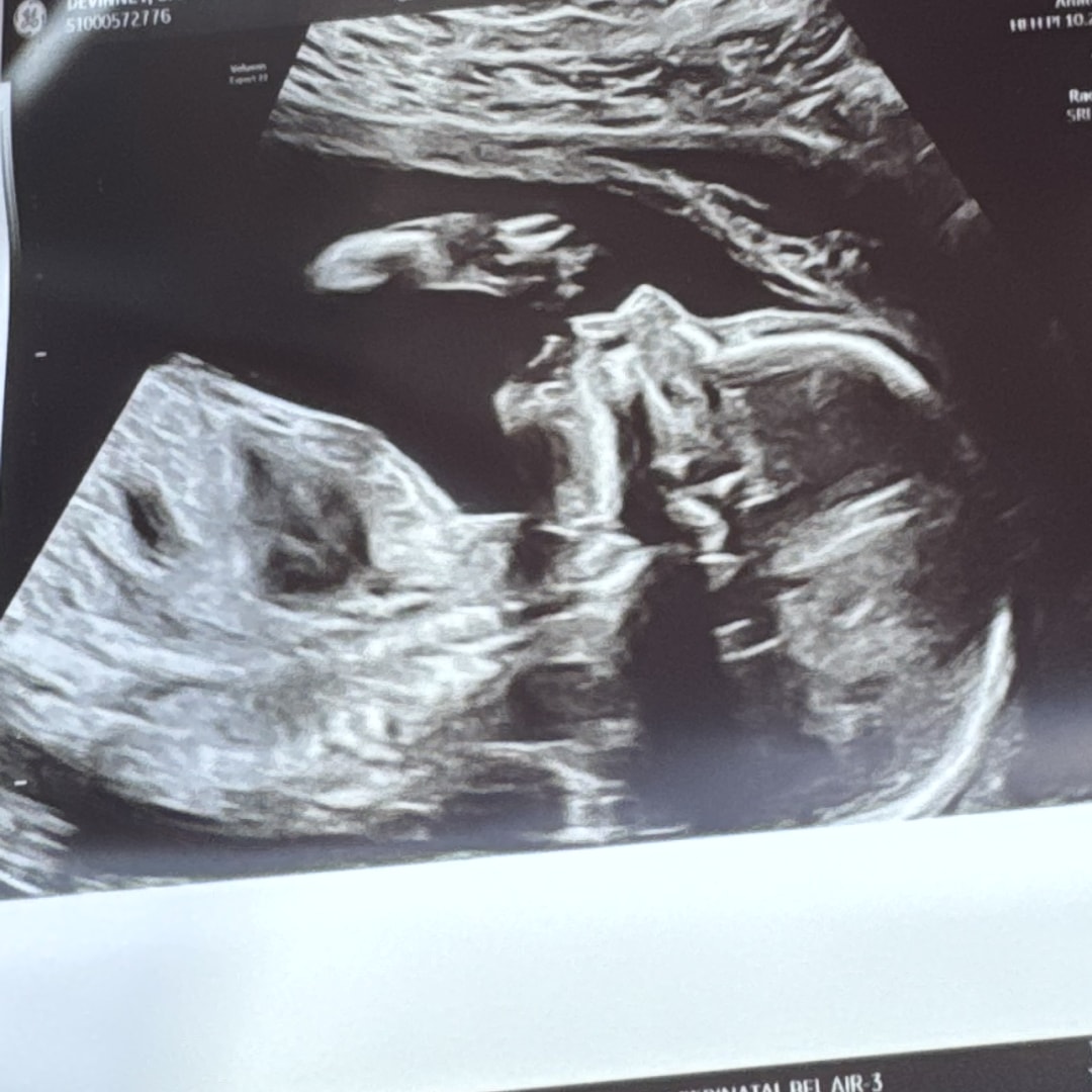 Photo shared by Caitlin for their Babylist baby registry.