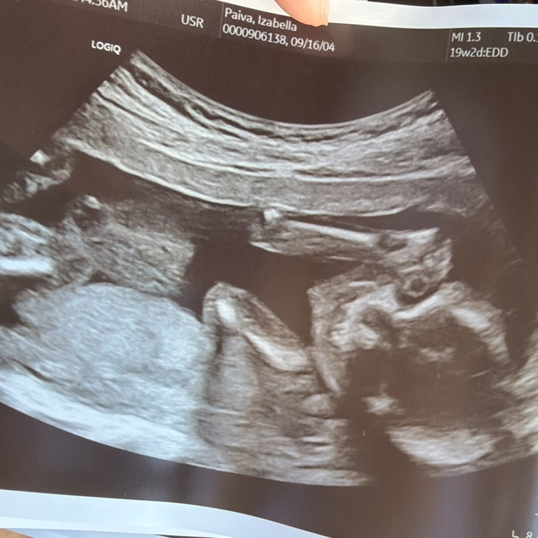 Photo shared by Izabella for their Babylist baby registry.