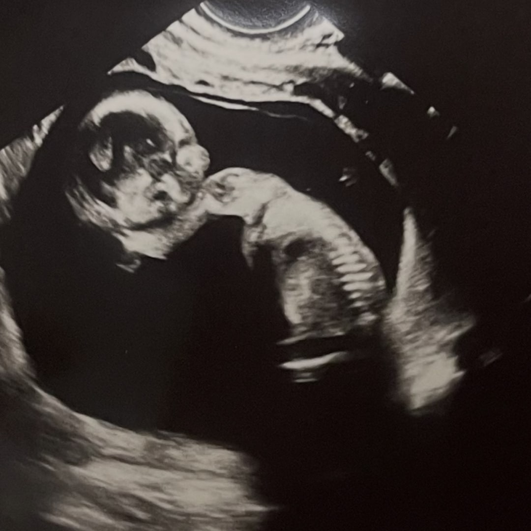 Photo shared by Alyssa for their Babylist baby registry.