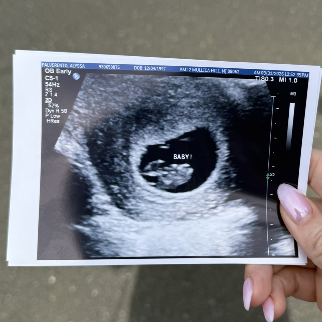 Photo shared by Alyssa for their Babylist baby registry.