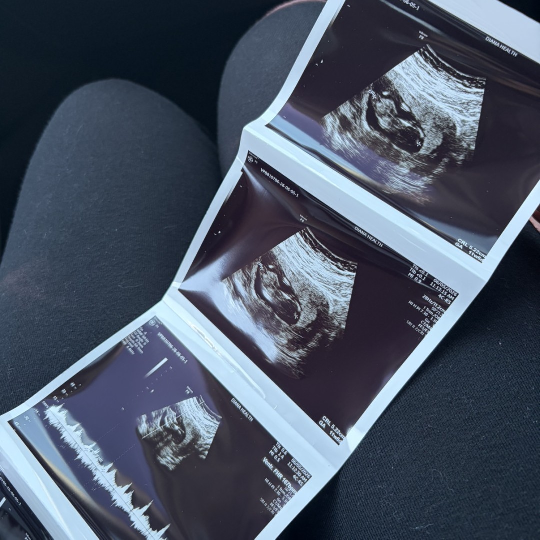 Photo shared by Gabriela for their Babylist baby registry.
