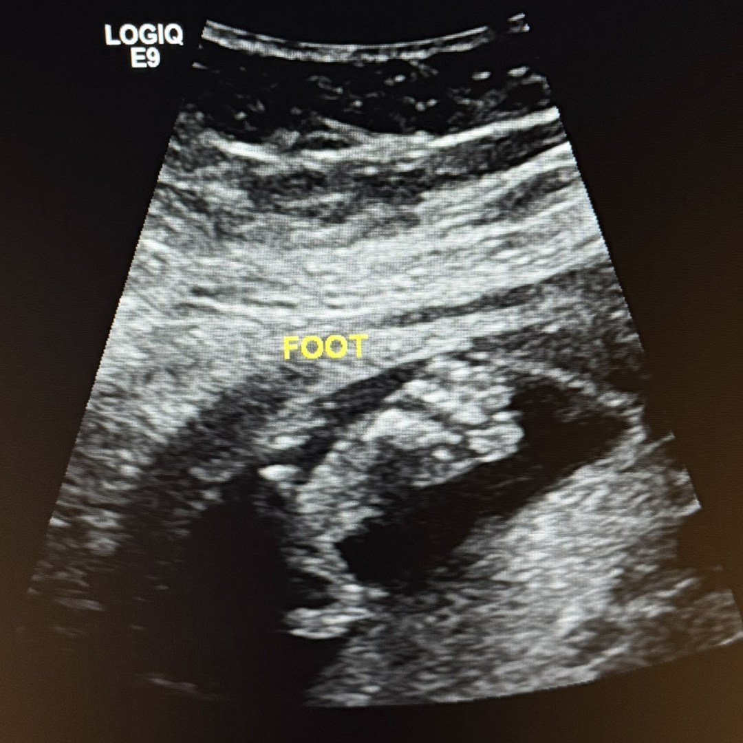 Photo shared by Kaitlin for their Babylist baby registry.