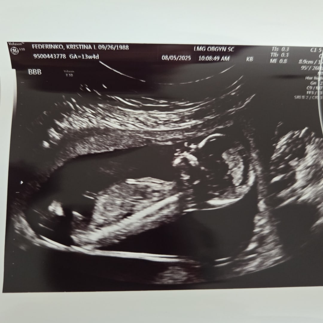 Photo shared by Kristina for their Babylist baby registry.