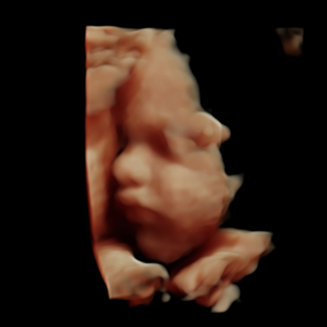 Photo shared by Abby for their Babylist baby registry.