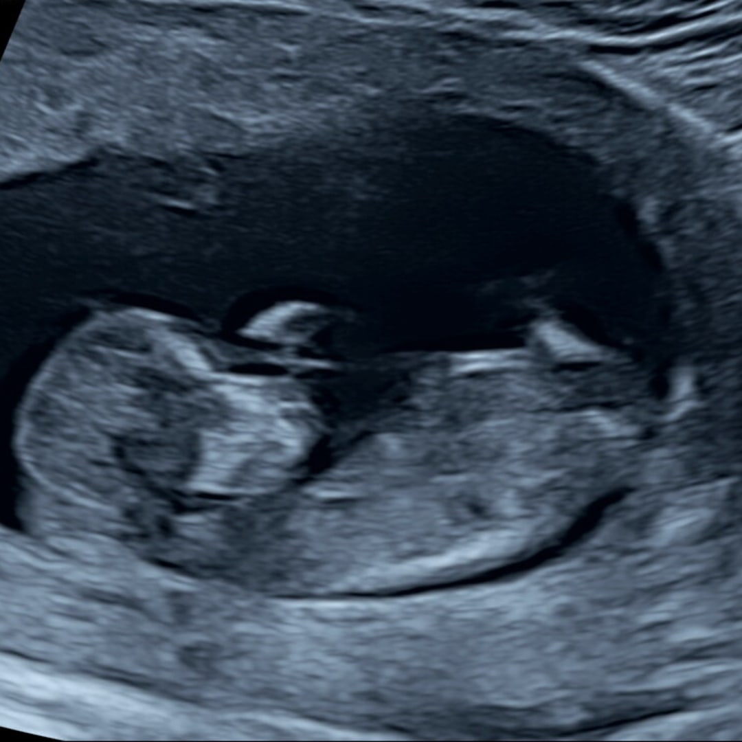 Photo shared by Naomi for their Babylist baby registry.