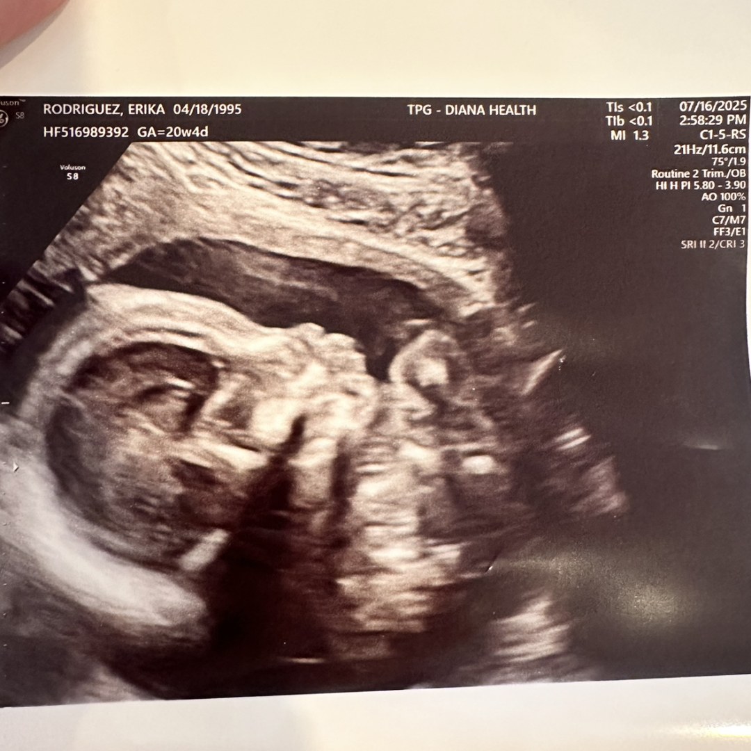 Photo shared by Erika for their Babylist baby registry.