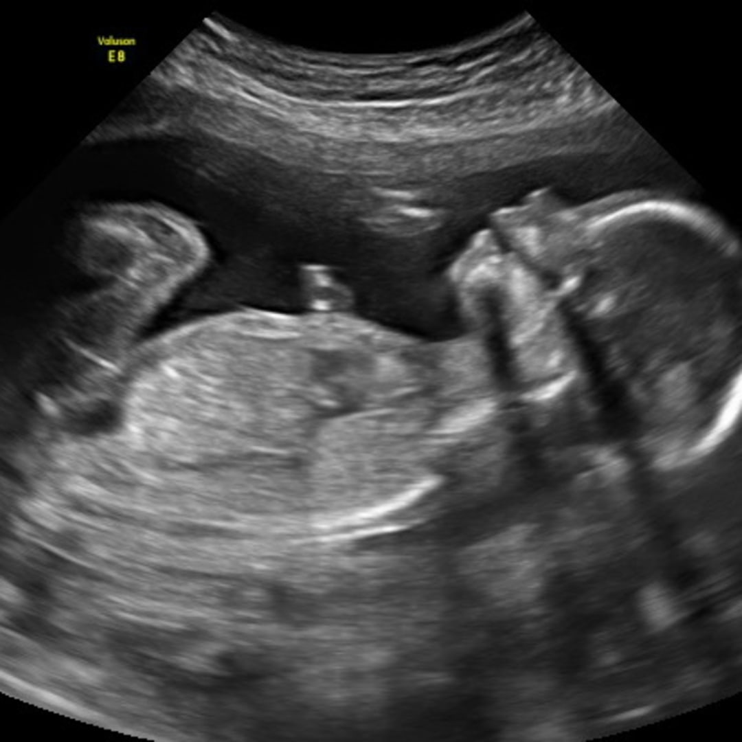 Photo shared by Alicia for their Babylist baby registry.