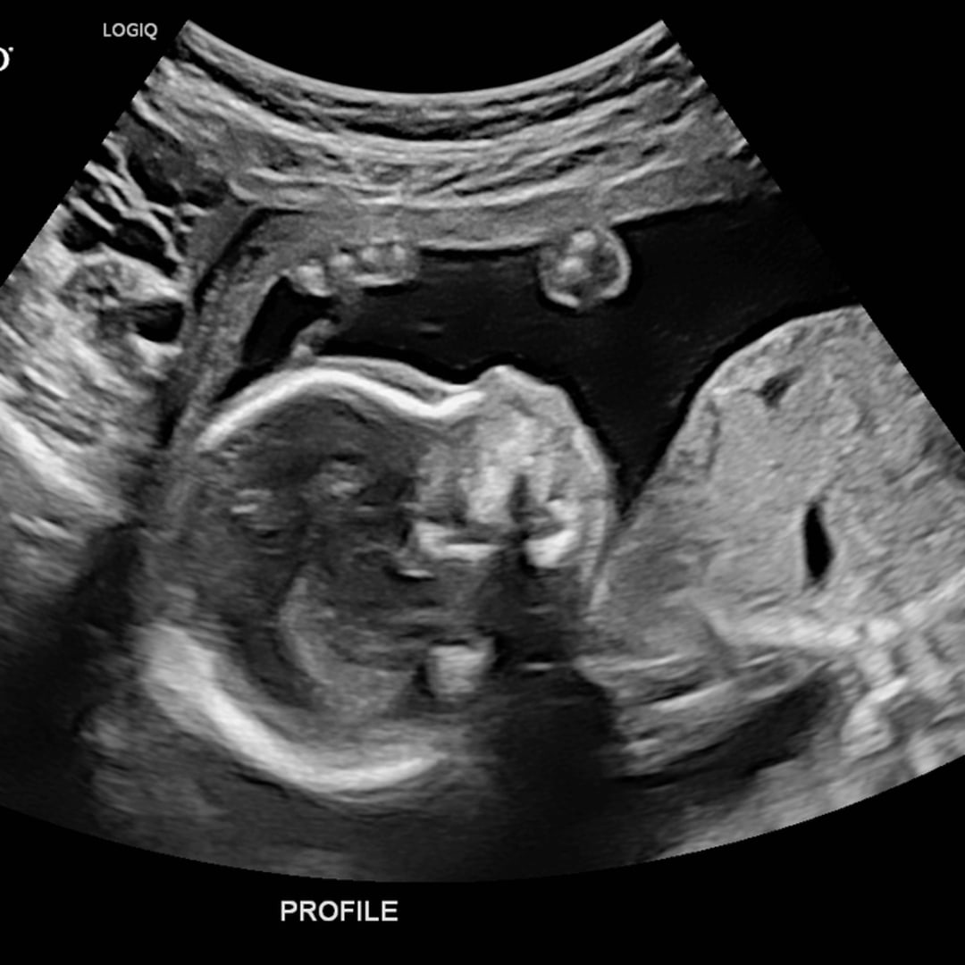 Photo shared by Amber for their Babylist baby registry.