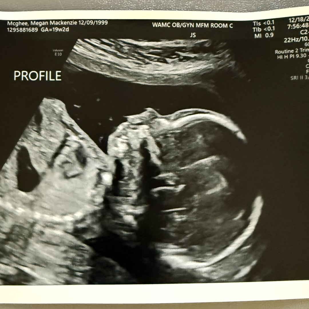 Photo shared by Megan for their Babylist baby registry.