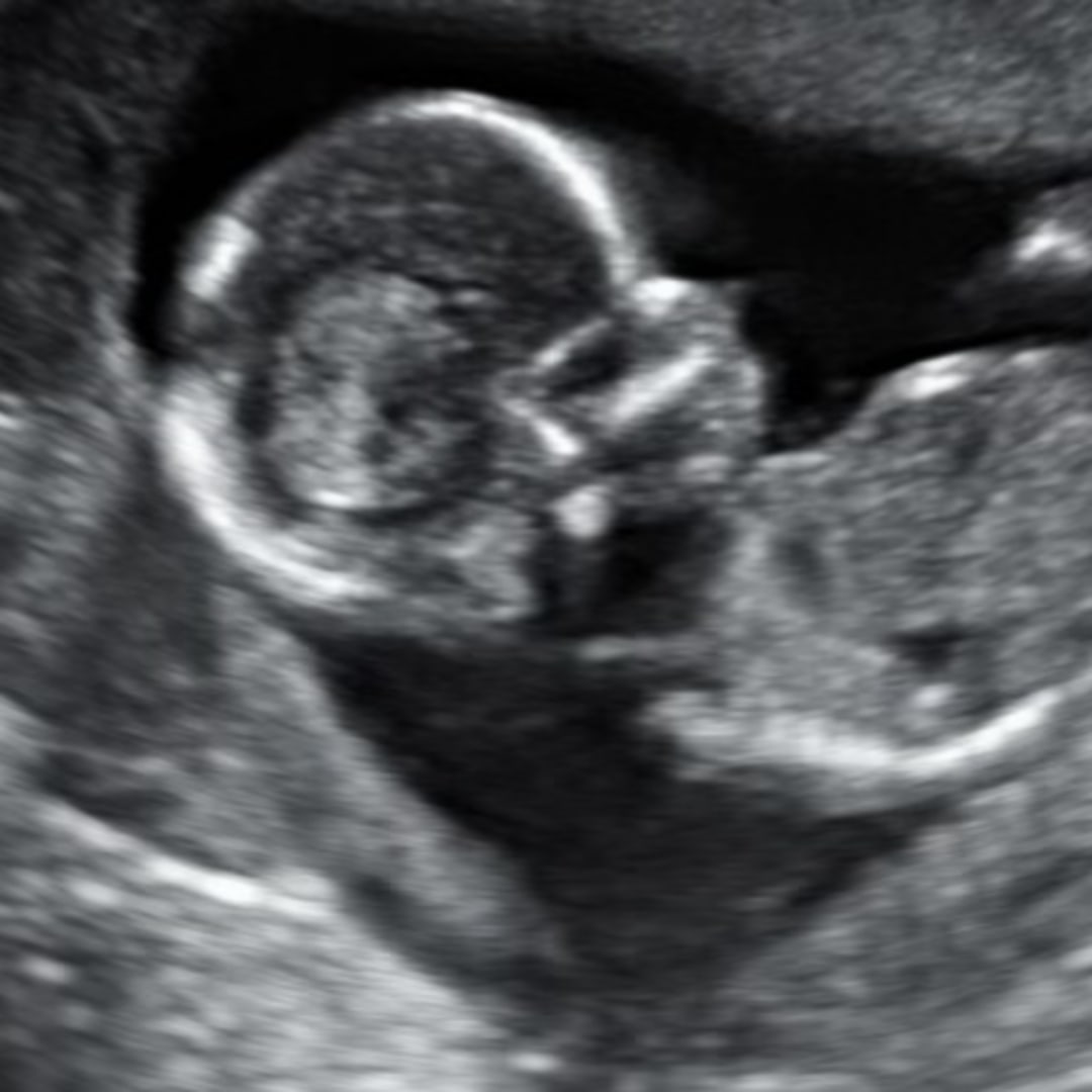 Photo shared by Bricely for their Babylist baby registry.