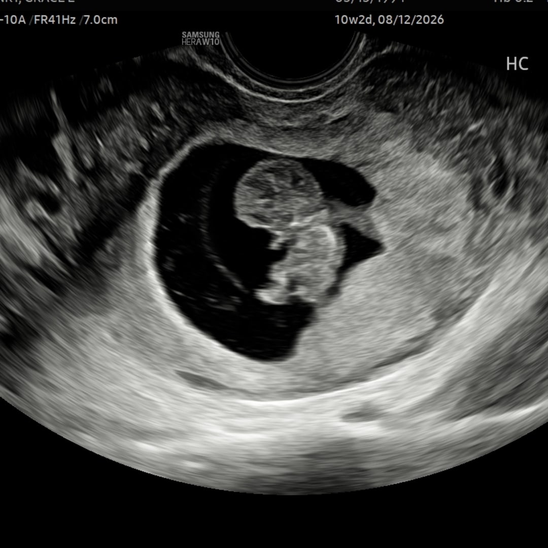 Photo shared by Grace for their Babylist baby registry.