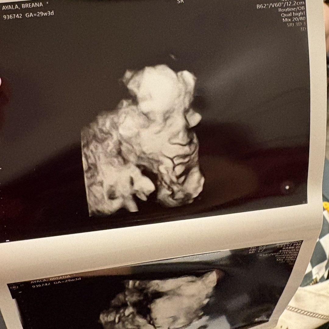 Photo shared by Breana for their Babylist baby registry.