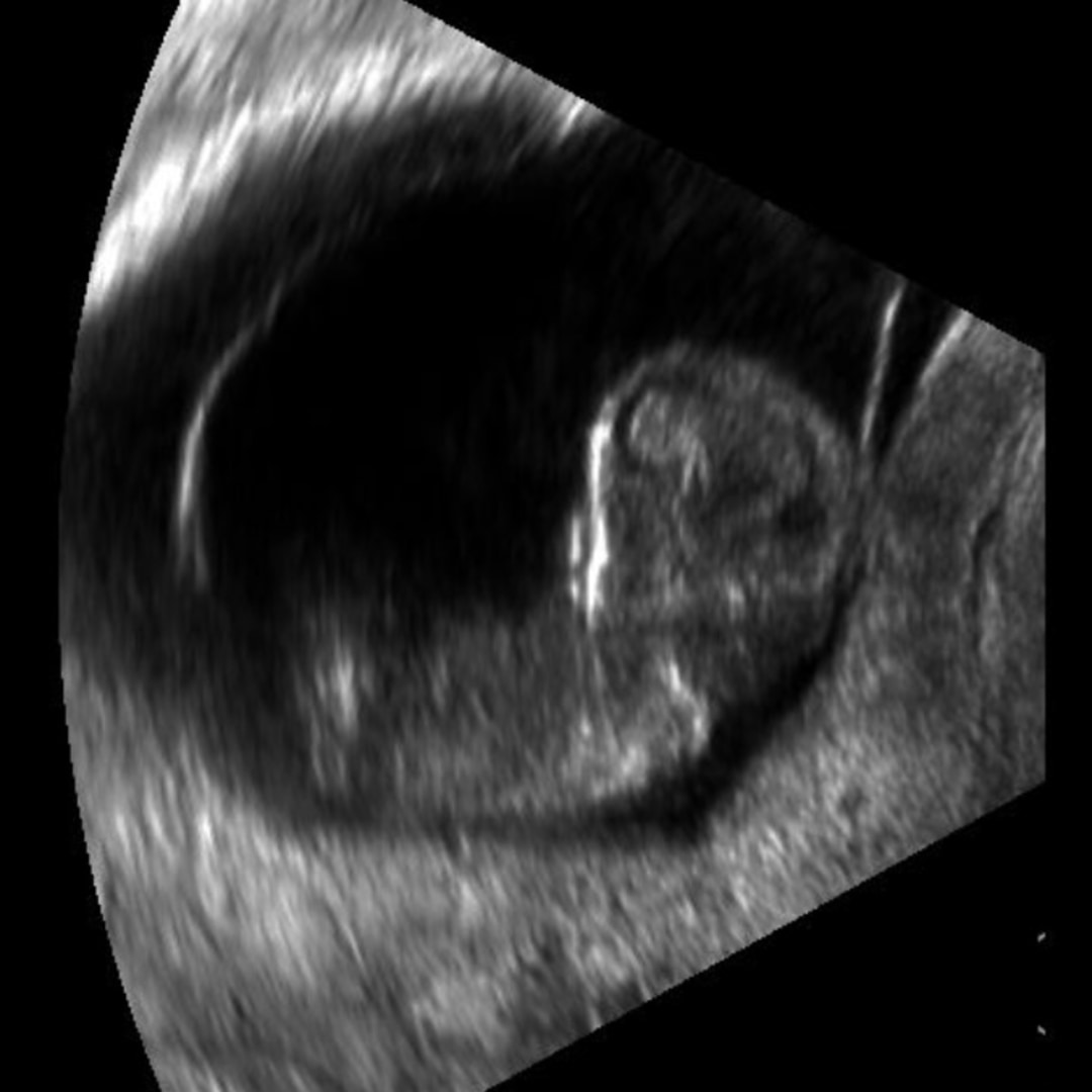 Photo shared by Cecily for their Babylist baby registry.