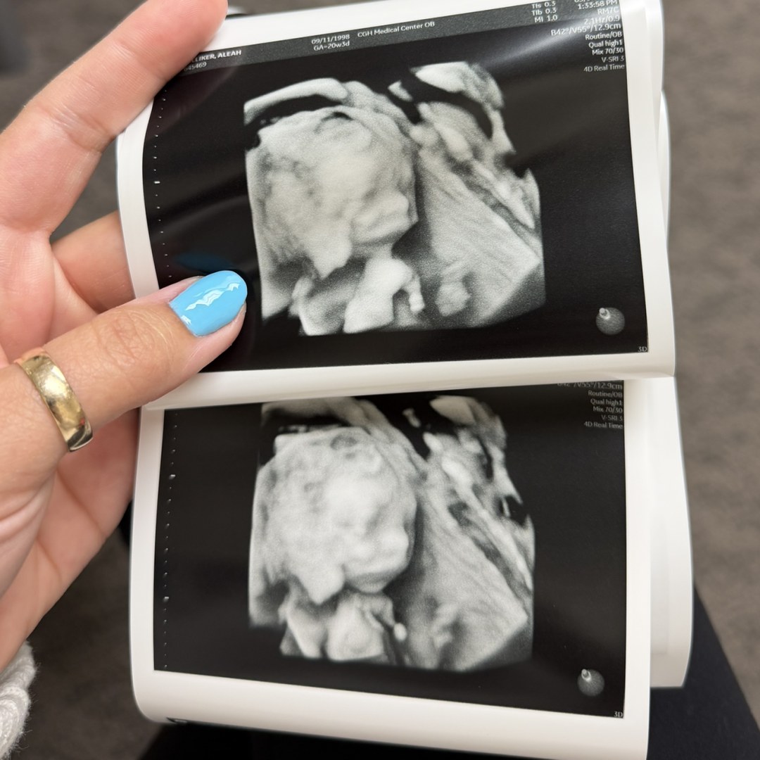 Photo shared by Aleah for their Babylist baby registry.