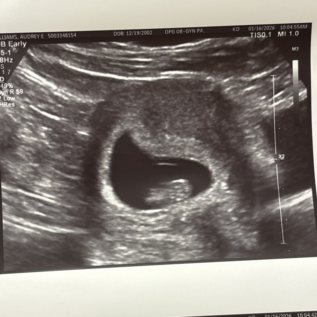 Photo shared by Audrey for their Babylist baby registry.