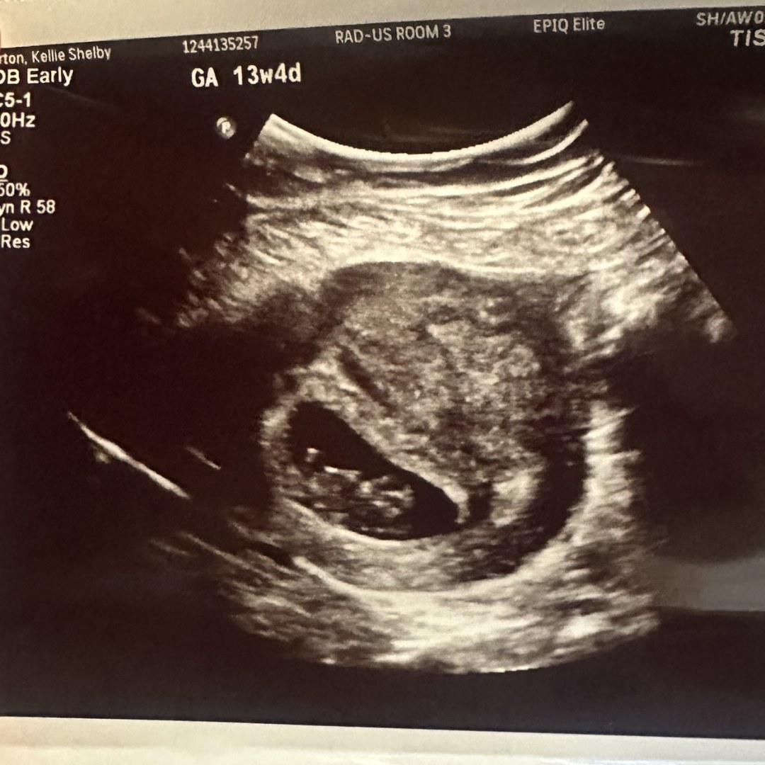 Photo shared by Kellie for their Babylist baby registry.