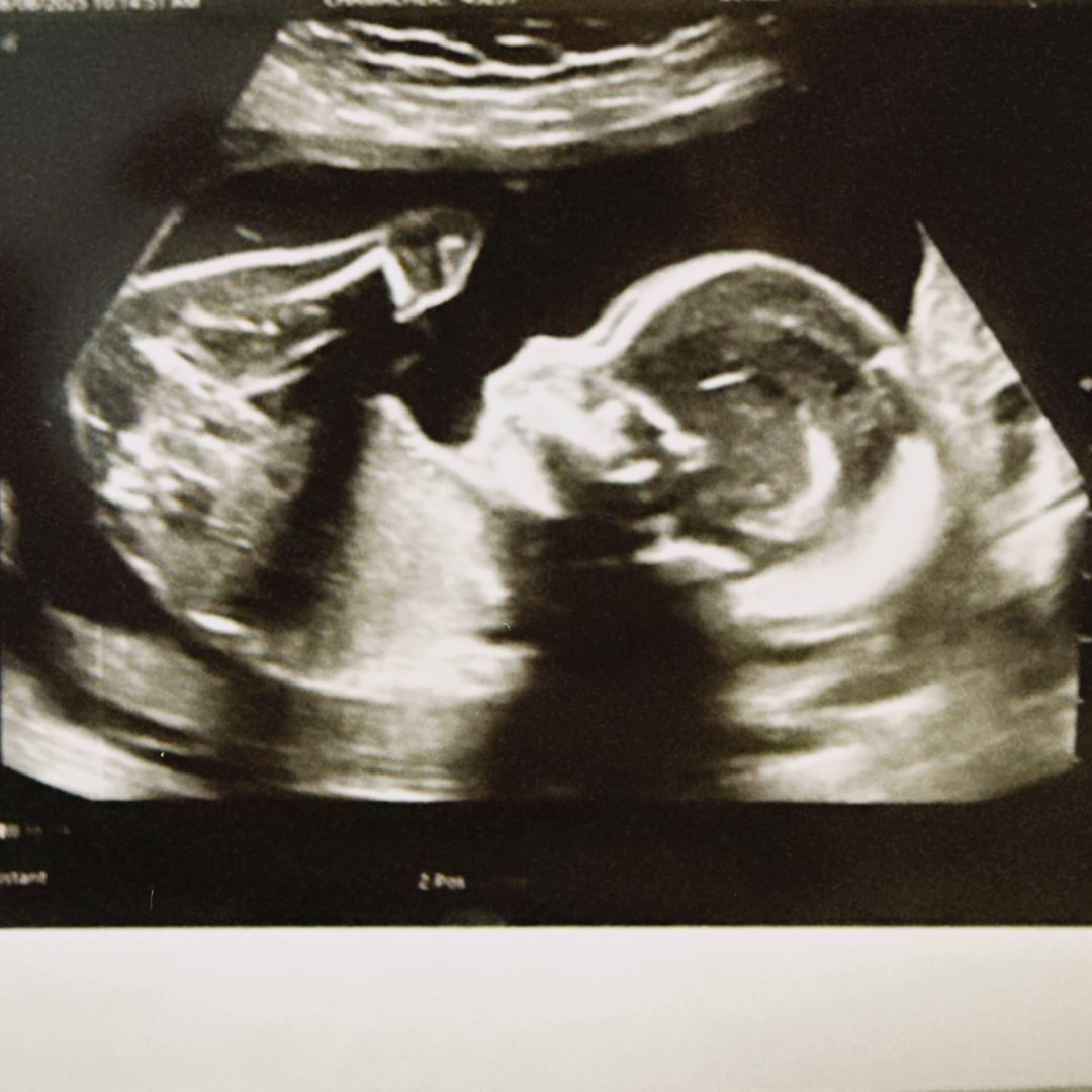 Photo shared by Caroline for their Babylist baby registry.