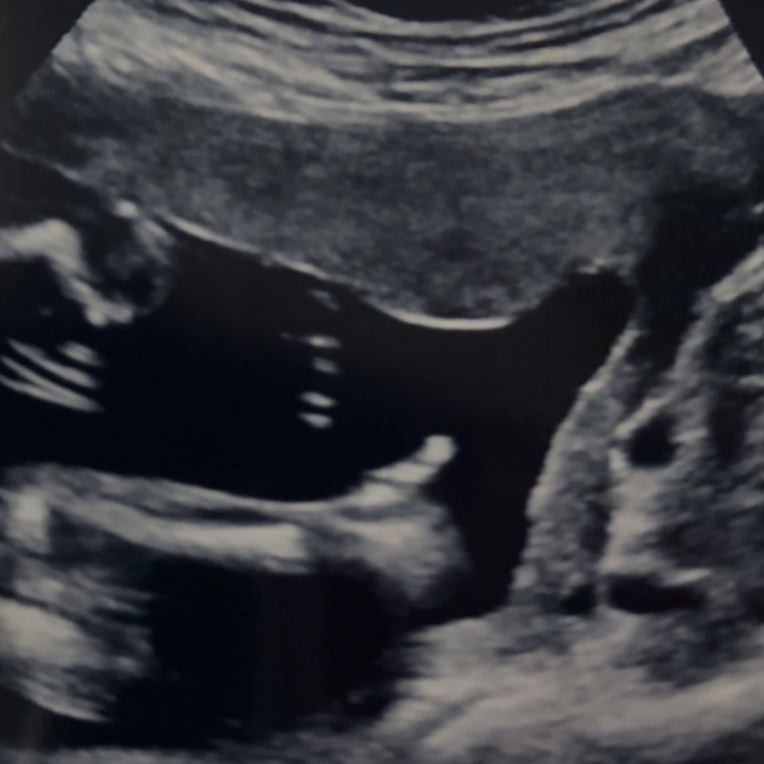 Photo shared by Brittany for their Babylist baby registry.