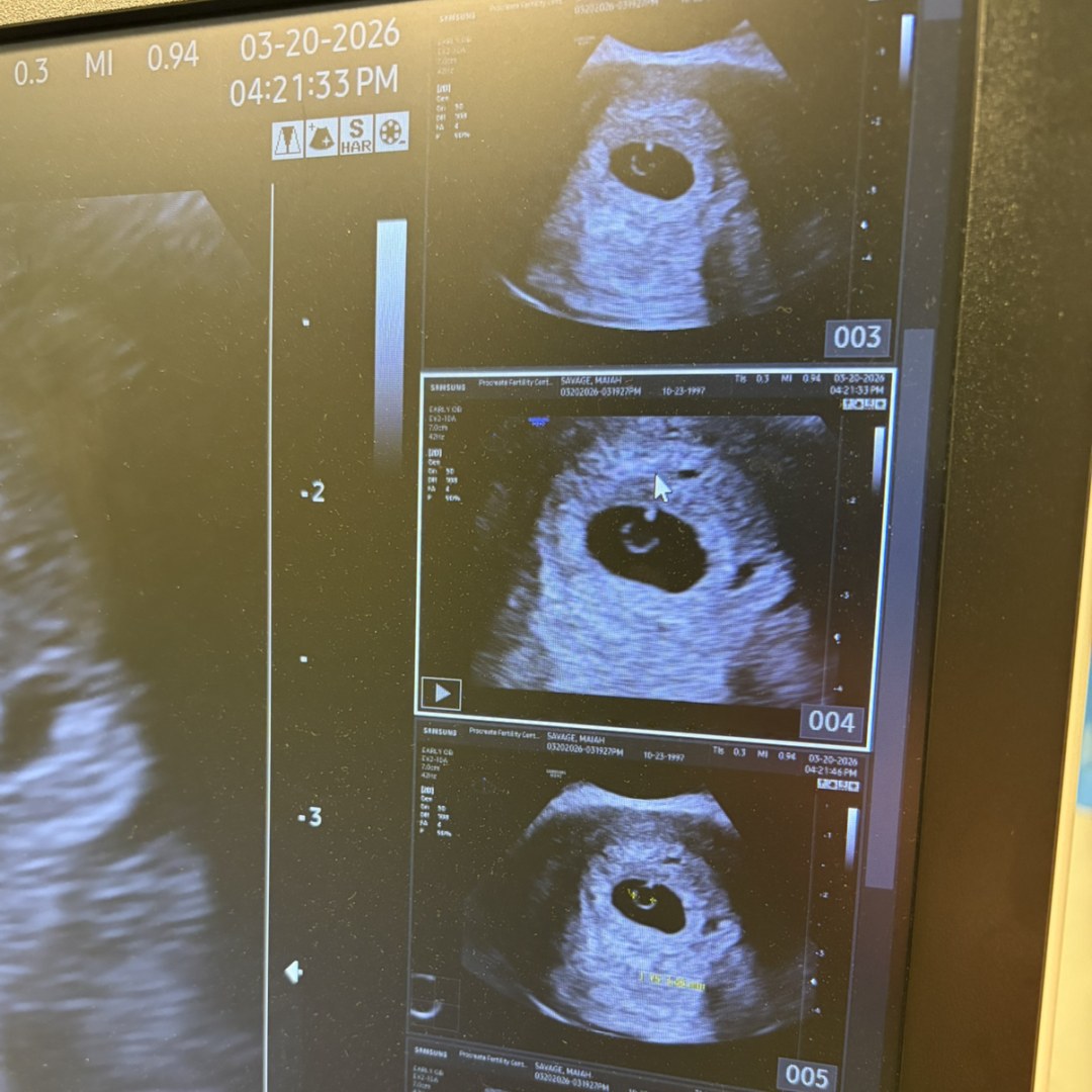 Photo shared by Maiah for their Babylist baby registry.