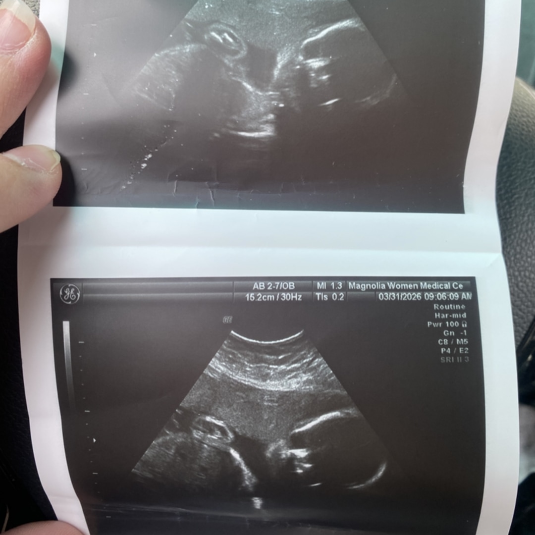 Photo shared by Bluecrystal for their Babylist baby registry.