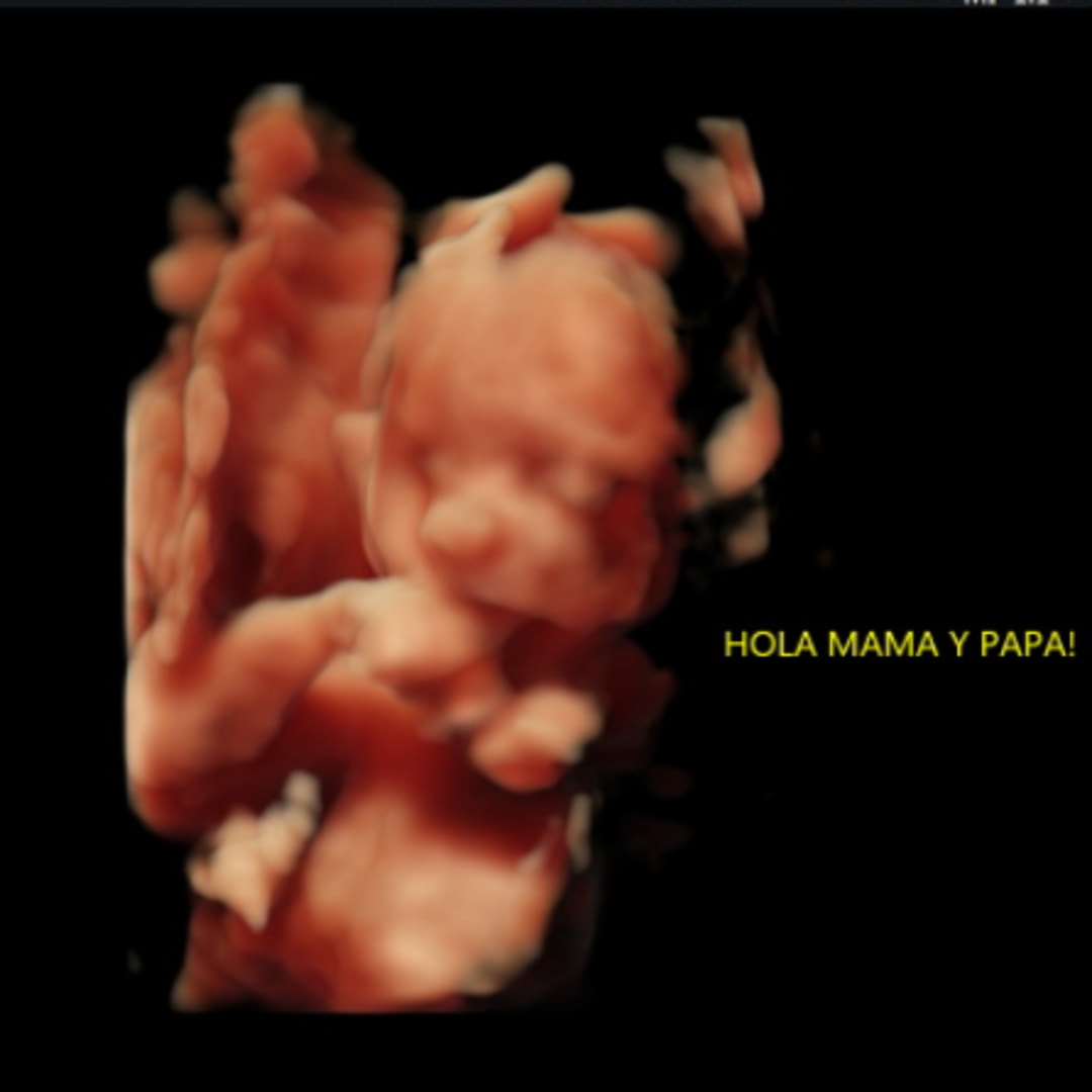 Photo shared by Isis for their Babylist baby registry.