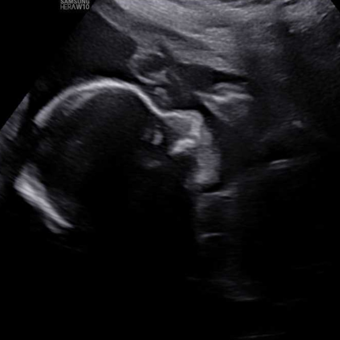 Photo shared by Hannah for their Babylist baby registry.