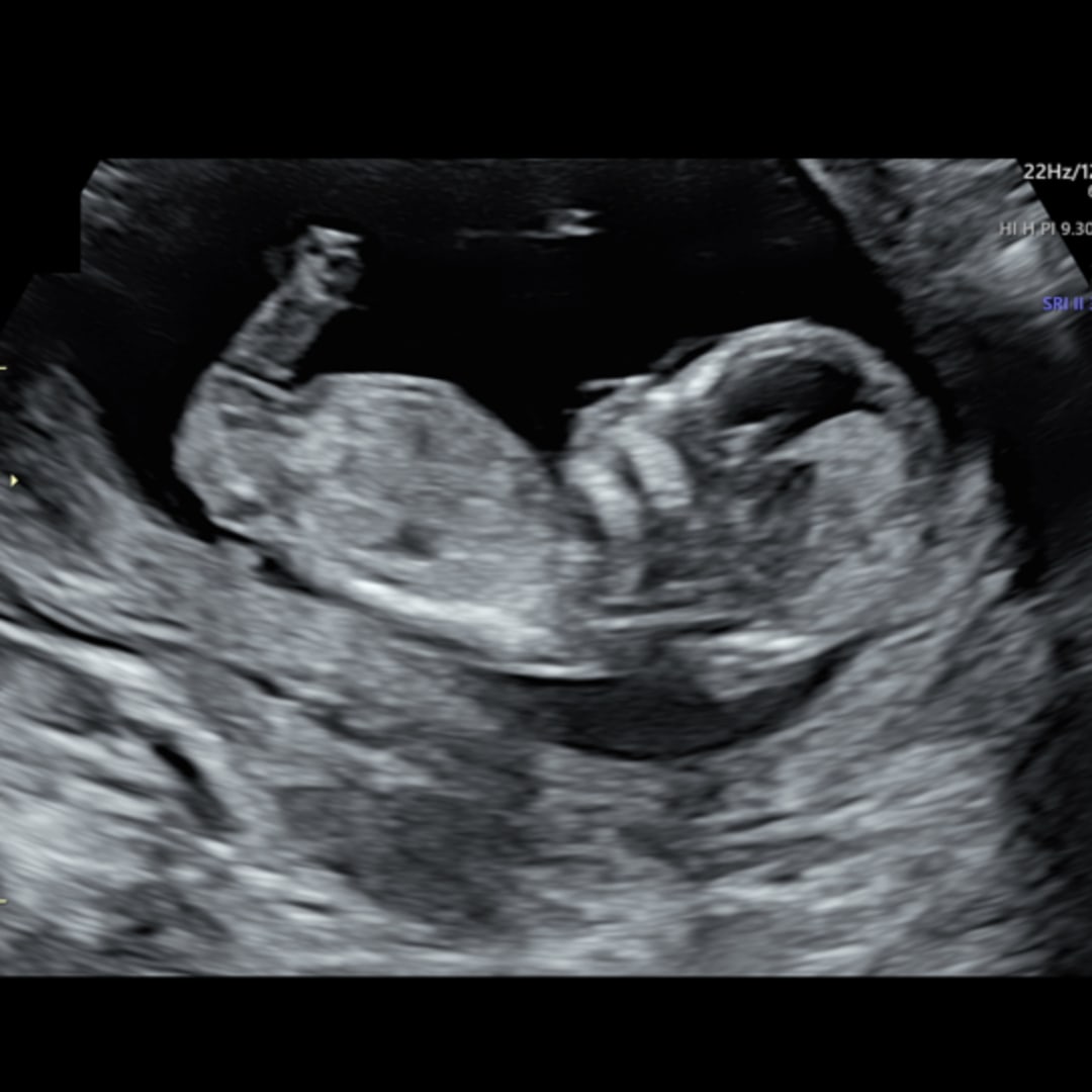 Photo shared by Monica for their Babylist baby registry.