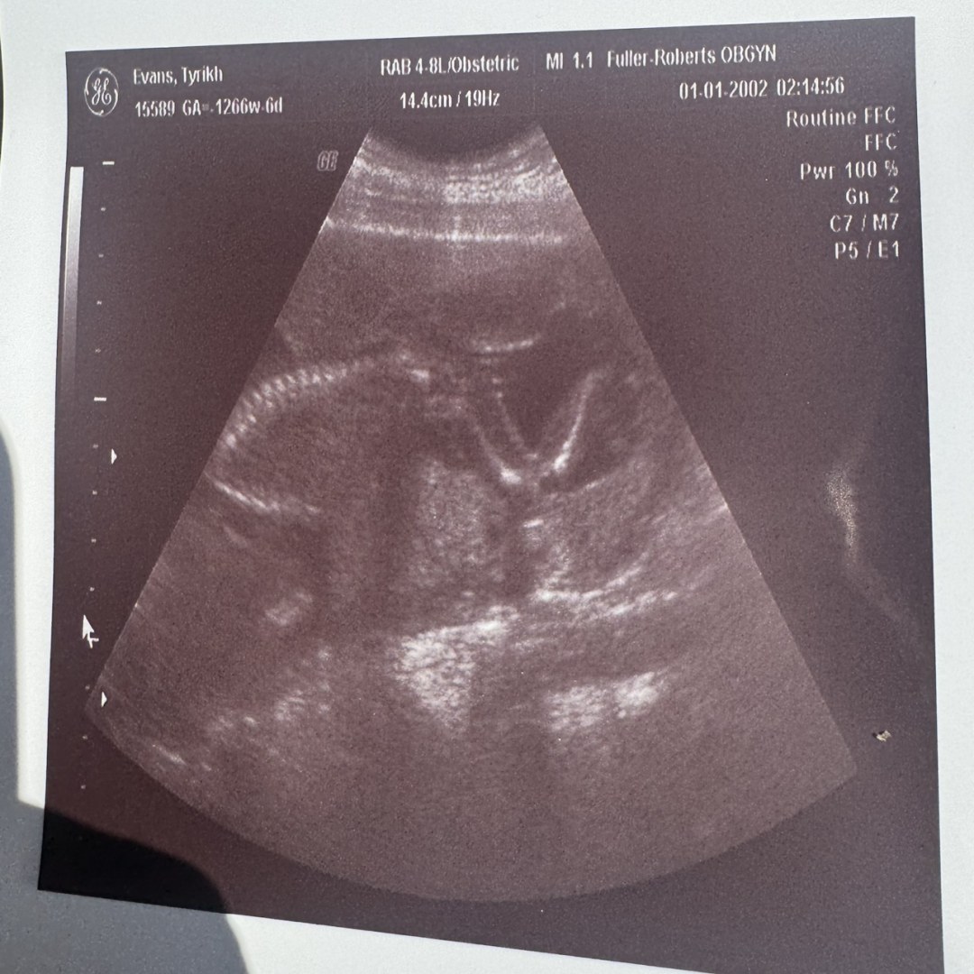 Photo shared by Danni for their Babylist baby registry.