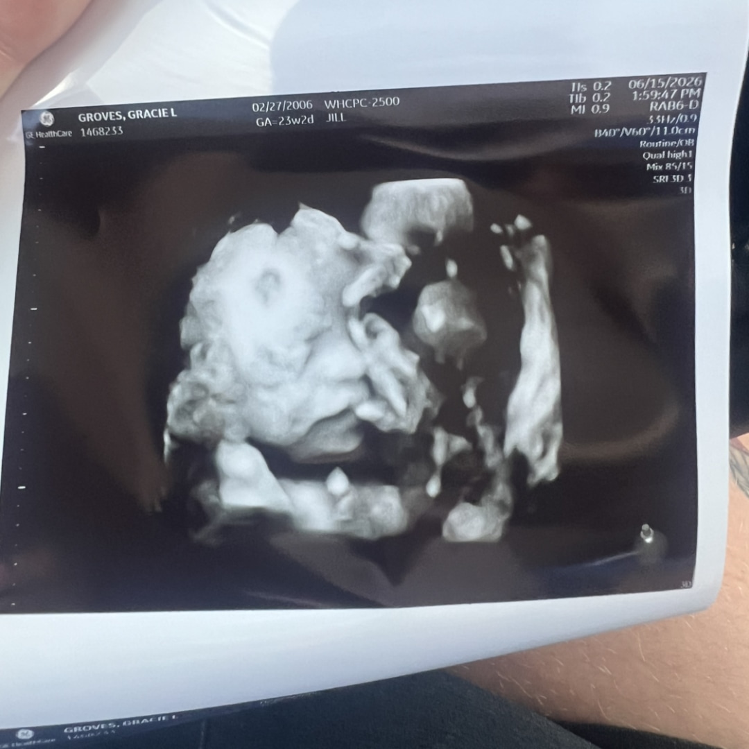 Photo shared by Gracie for their Babylist baby registry.
