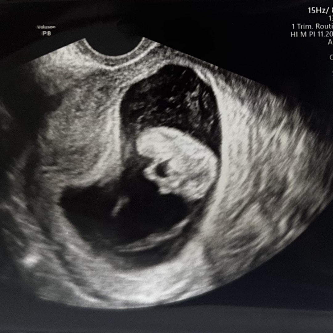 Photo shared by Charline for their Babylist baby registry.