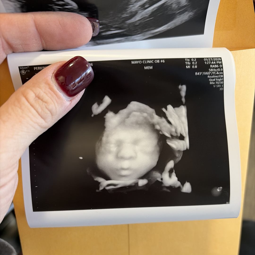 Photo shared by Kristin for their Babylist baby registry.