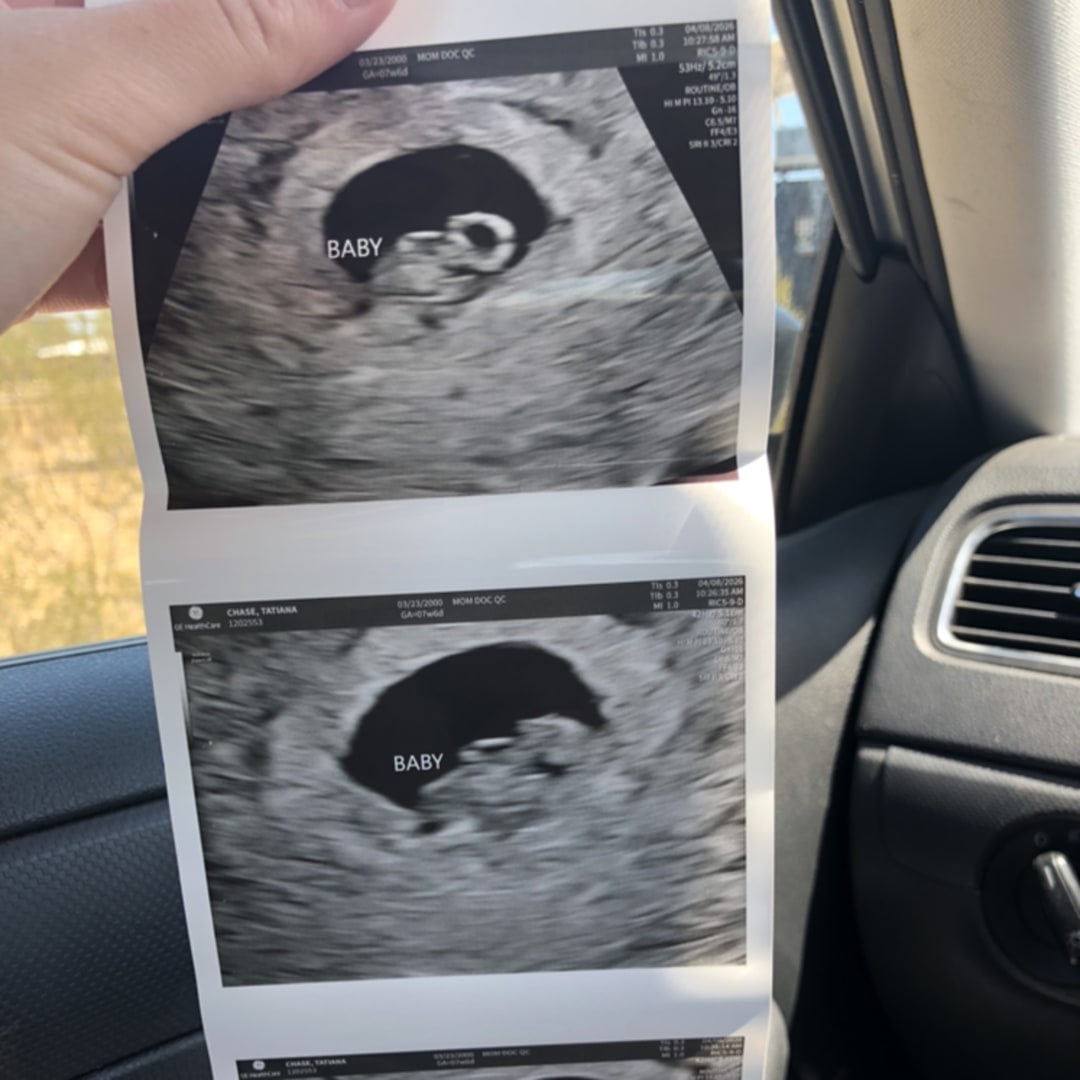 Photo shared by Tati for their Babylist baby registry.