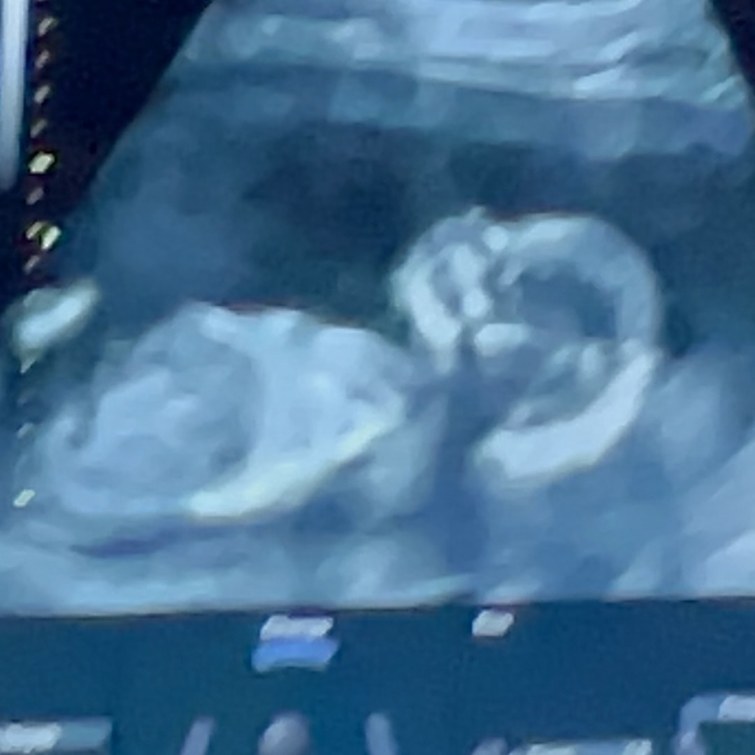 Photo shared by Ariz for their Babylist baby registry.