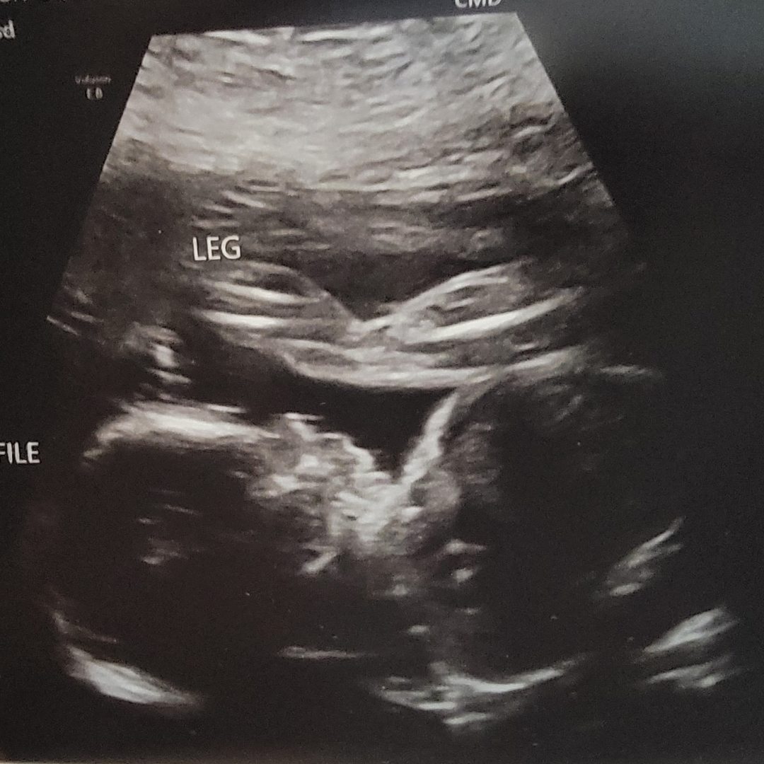 Photo shared by Shannon for their Babylist baby registry.