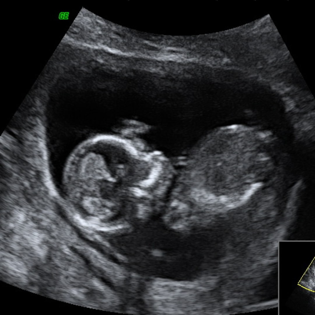 Photo shared by Isabela for their Babylist baby registry.