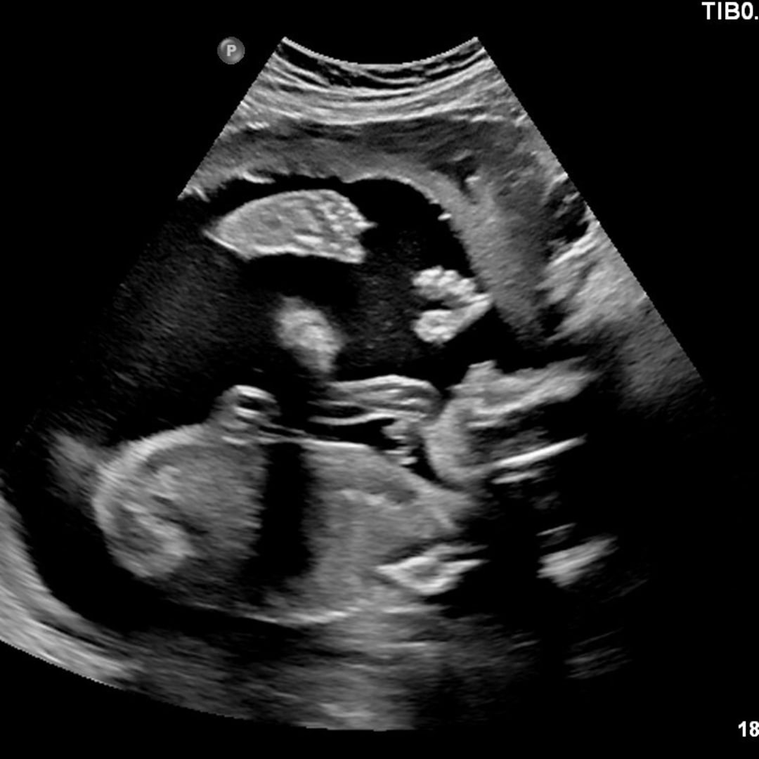 Photo shared by Andrea for their Babylist baby registry.
