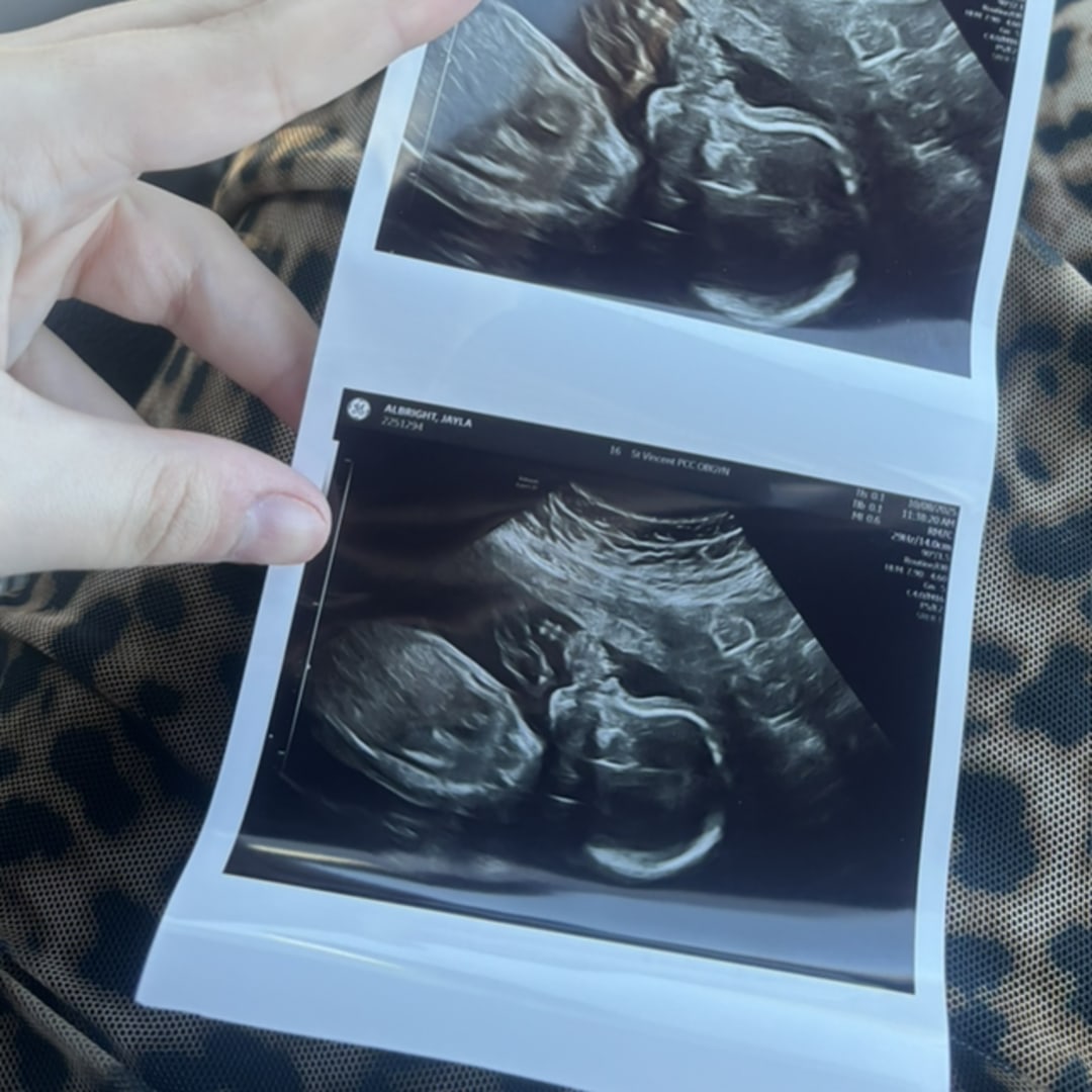 Photo shared by Jayla for their Babylist baby registry.