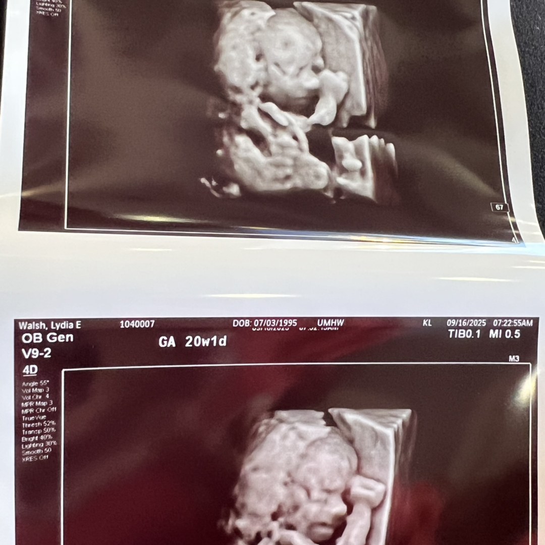 Photo shared by Lydia for their Babylist baby registry.