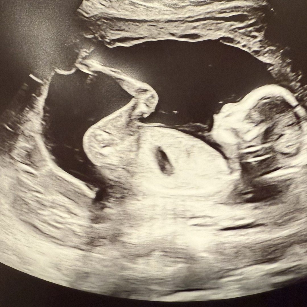 Photo shared by Brittani for their Babylist baby registry.