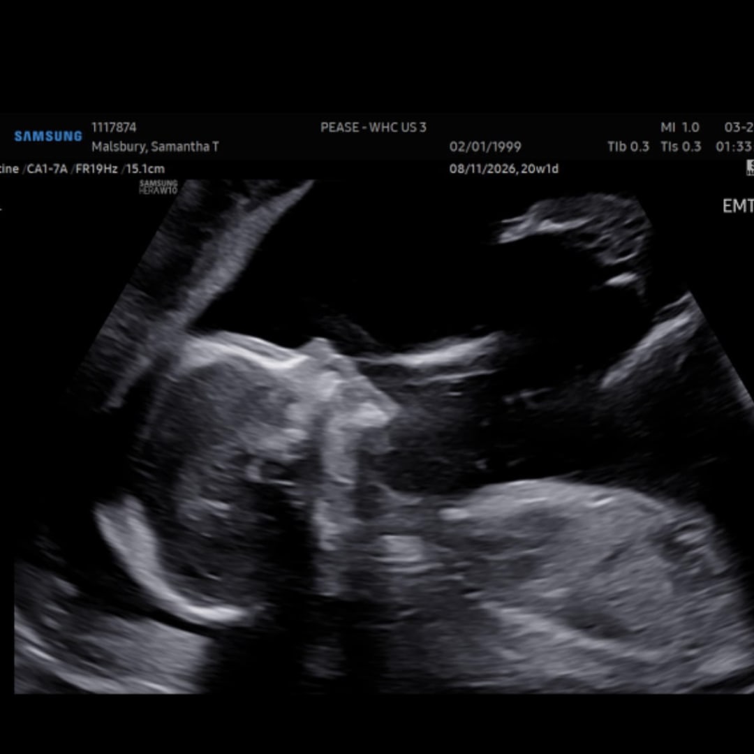 Photo shared by Samantha for their Babylist baby registry.