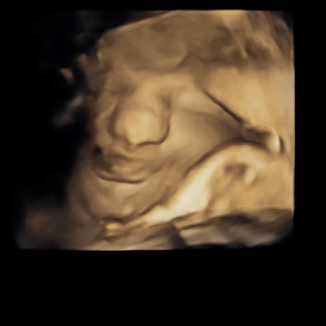 Photo shared by Lacy for their Babylist baby registry.