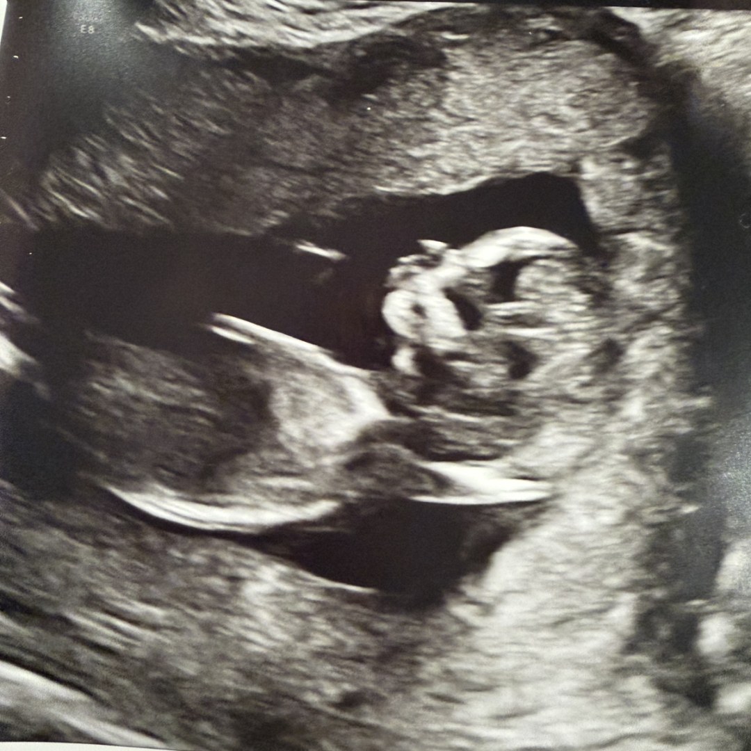 Photo shared by Aileen for their Babylist baby registry.