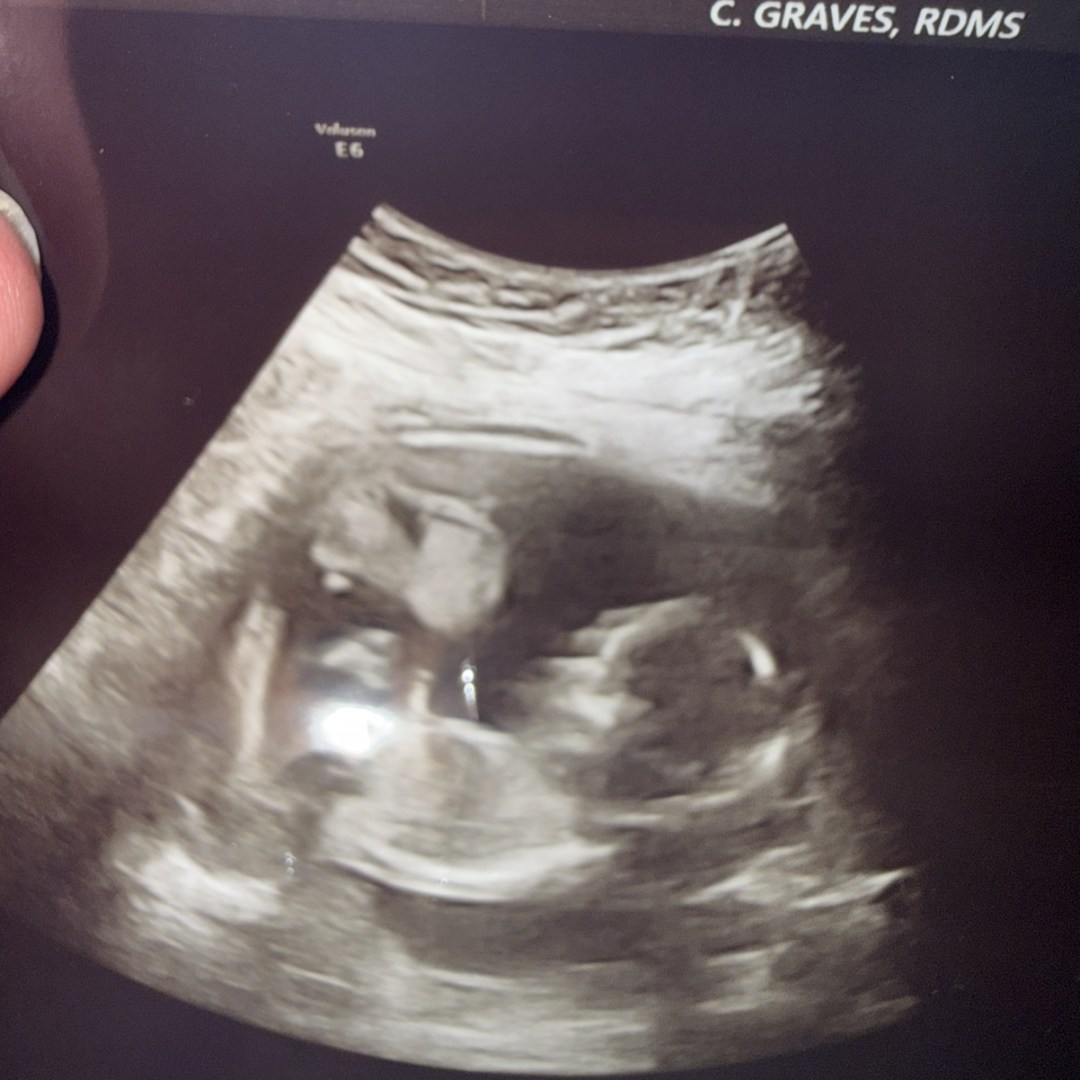 Photo shared by Iveth for their Babylist baby registry.