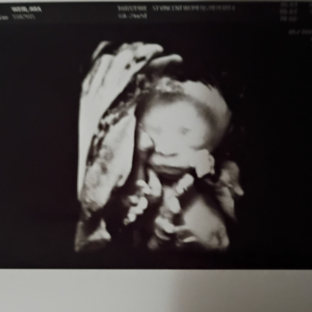 Photo shared by Ara for their Babylist baby registry.