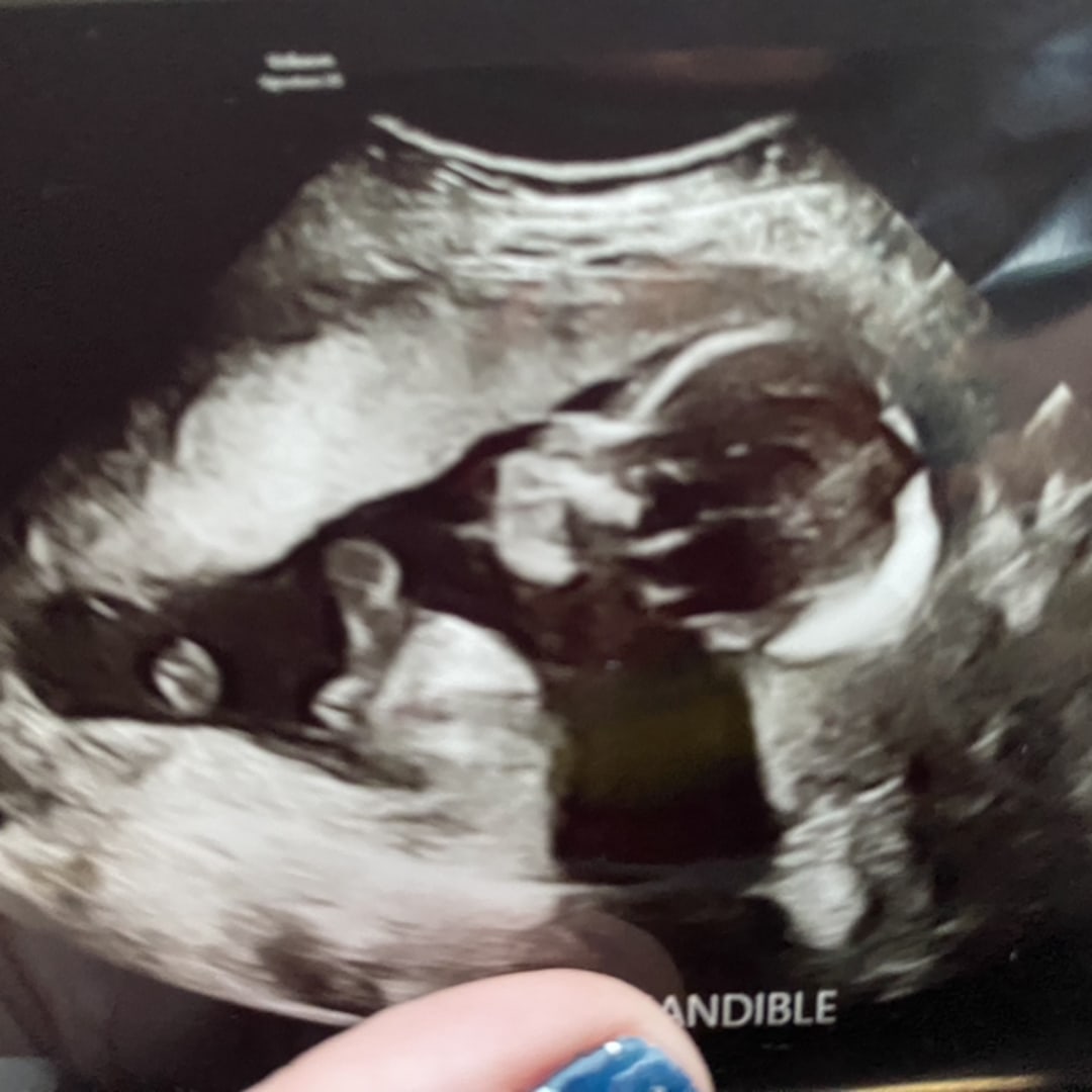 Photo shared by Heather and Bob for their Babylist baby registry.