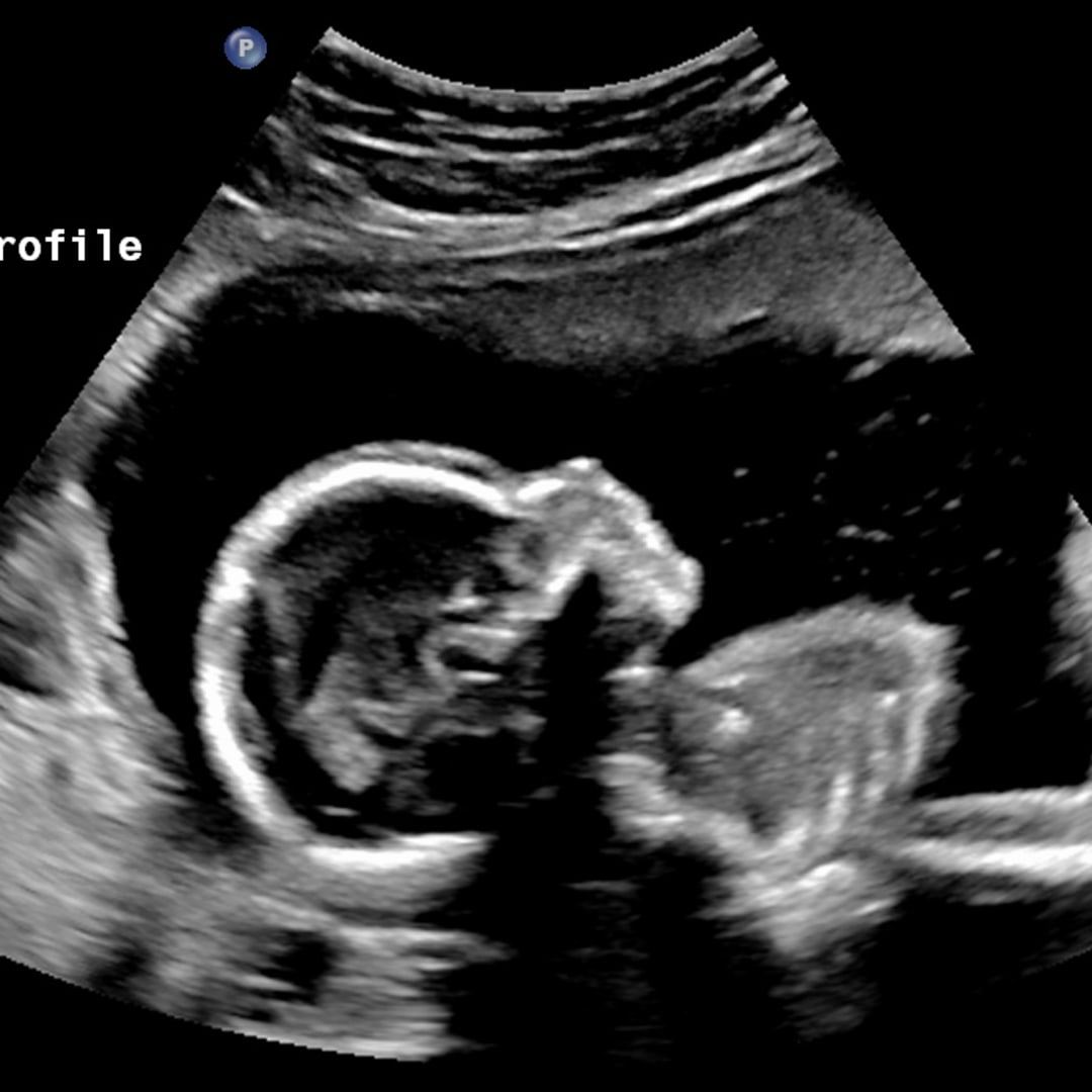 Photo shared by Danna for their Babylist baby registry.