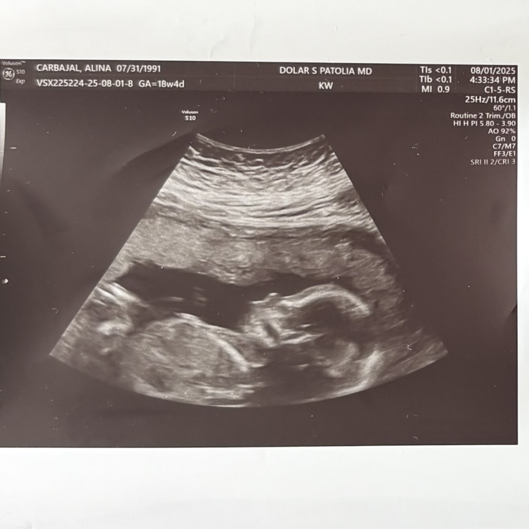 Photo shared by Alina for their Babylist baby registry.