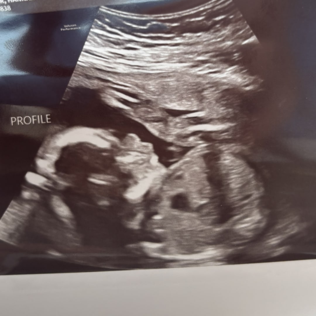 Photo shared by Hannah for their Babylist baby registry.