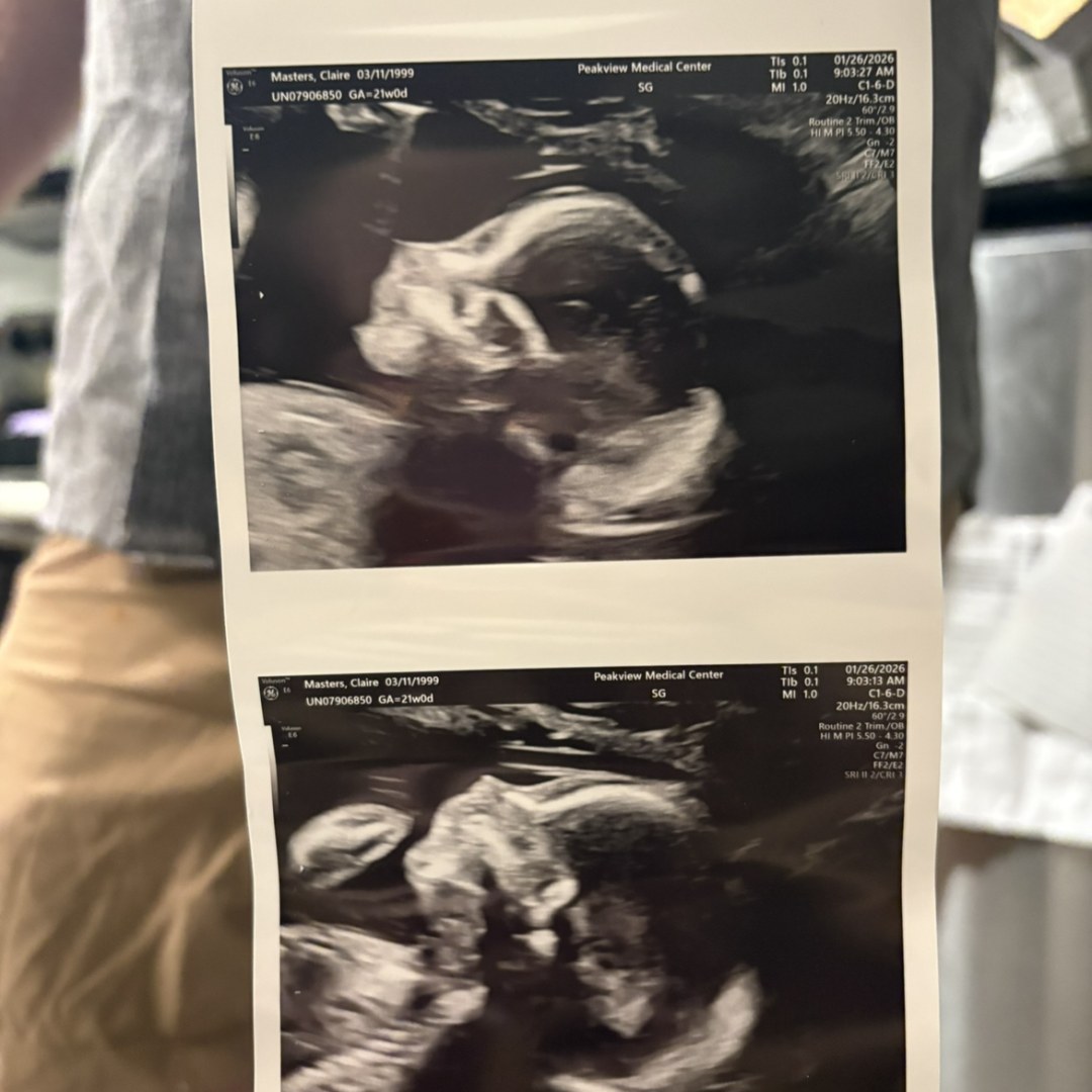 Photo shared by Claire for their Babylist baby registry.