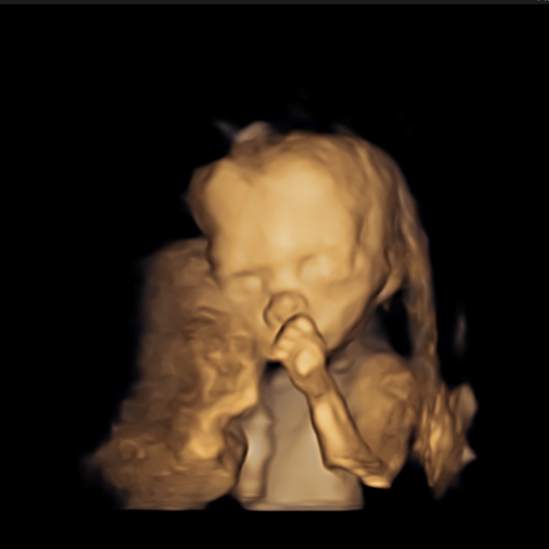 Photo shared by Shea for their Babylist baby registry.